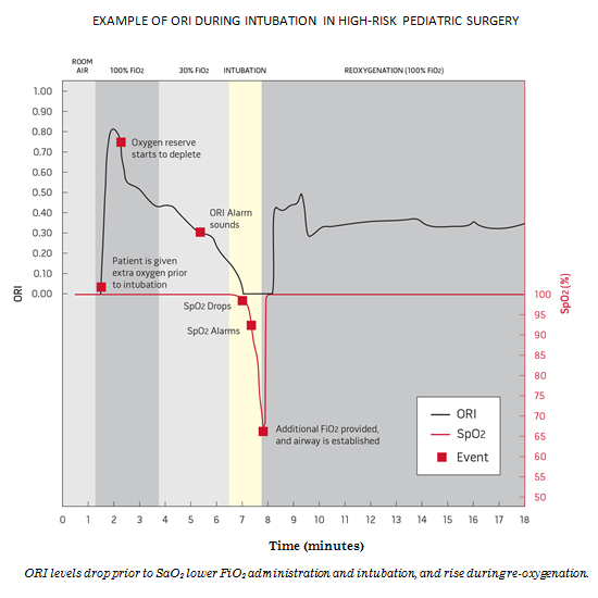 Graph showing example of ORI during intubation in high-risk pediatric surgeries