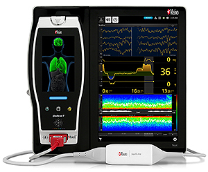 https://www.masimo.com/globalassets/images/newsmedia/2016/root_sedline.jpeg