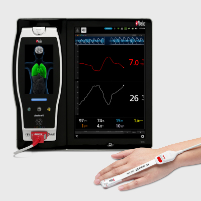 clinician looking at screen with Masimo Uniview displayed