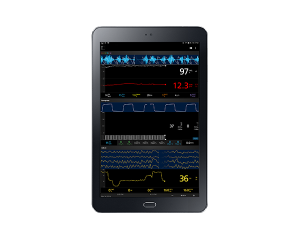 Kite Tablet displaying data