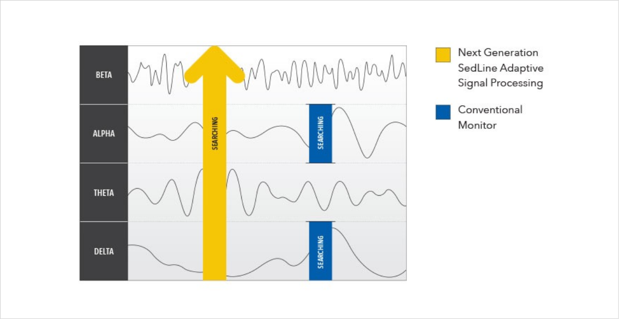 Adaptive Signal Processing Graph