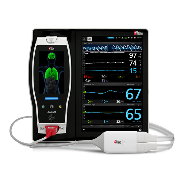 Root® with O3® Regional Oximetry