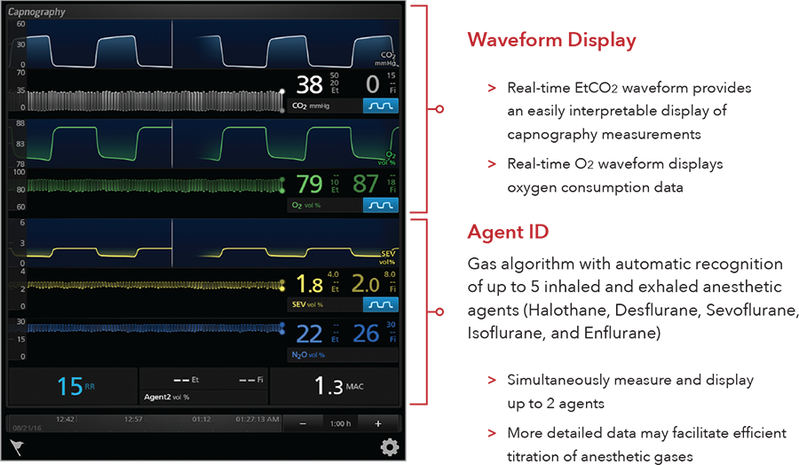 UI screen displaying waveforms on the Masimo Root