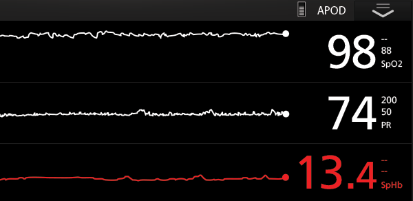 Trend Data