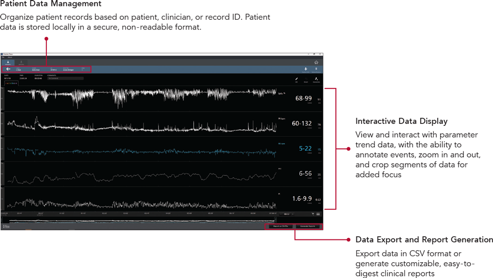 Masimo - Trace - Data Display