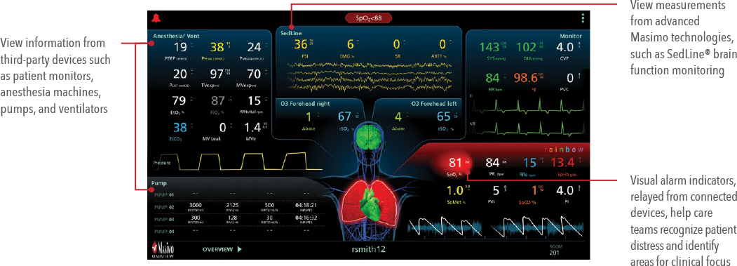 Masimo - Uniview - Patient Data