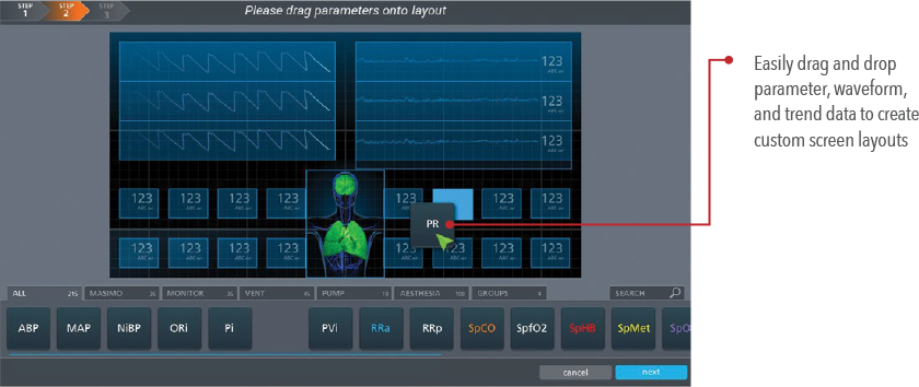 Uniview - UI of customizable screen layouts