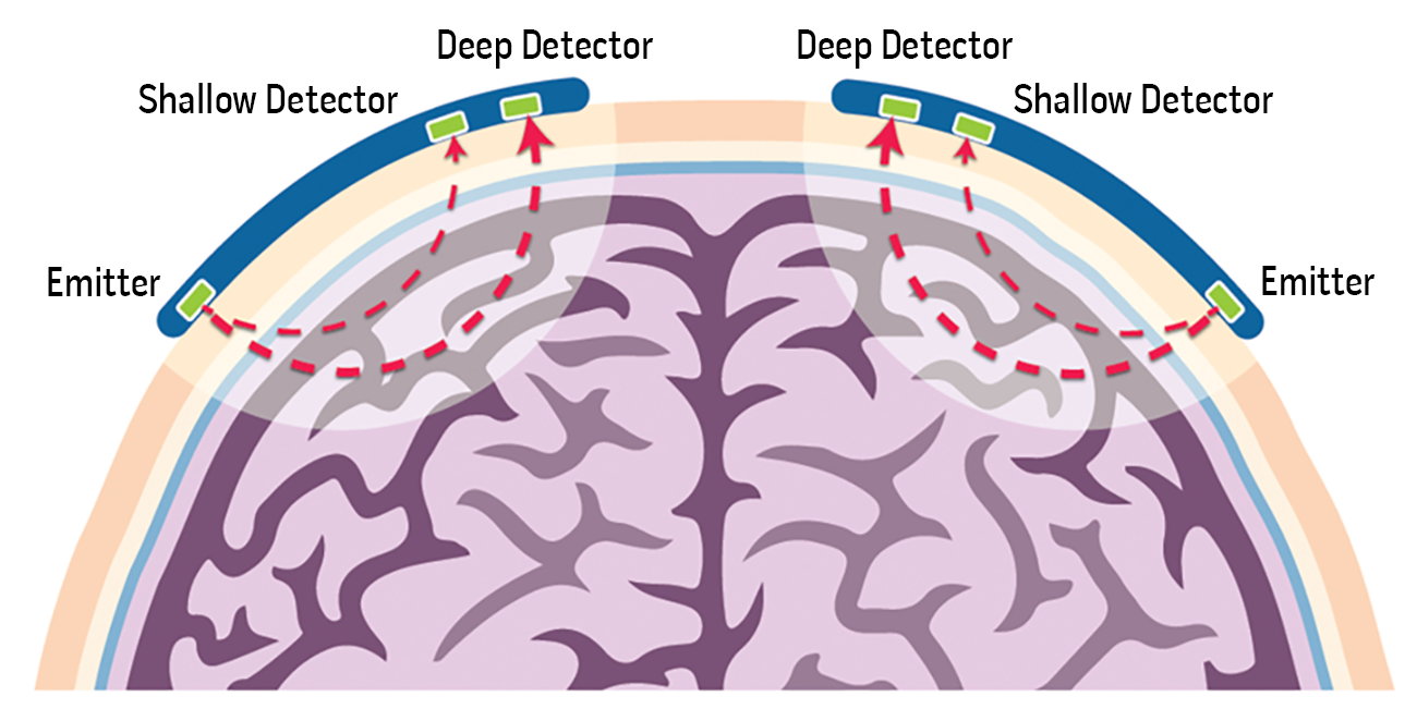 O3 Detection Paths