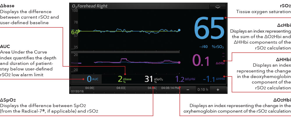 Masimo - O3 Display Cerebral Oximetry