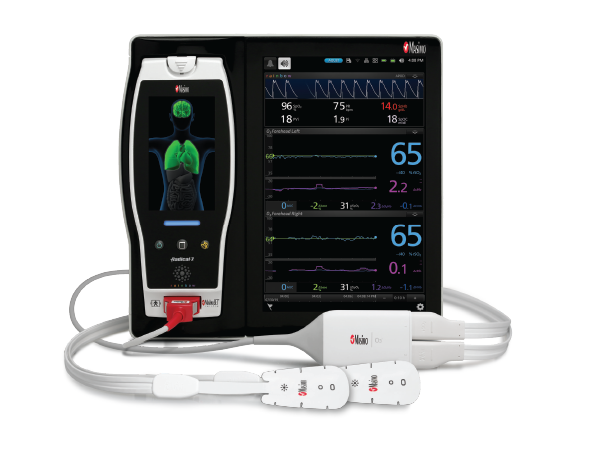 The Benefits of Masimo’s O3<sup>®</sup> Regional Oximetry - US